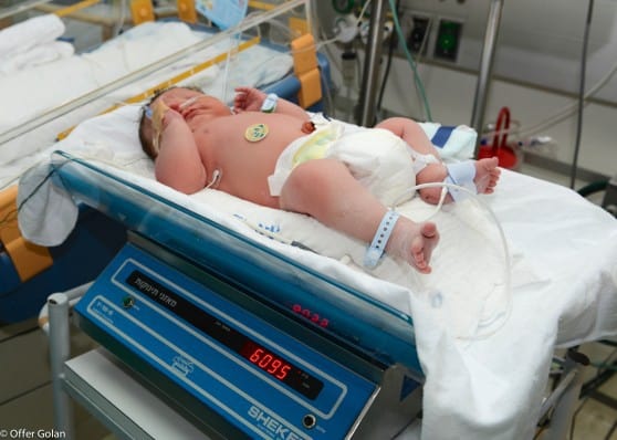 תינוק במשקל 6.2 ק"ג נולד ברמב"ם