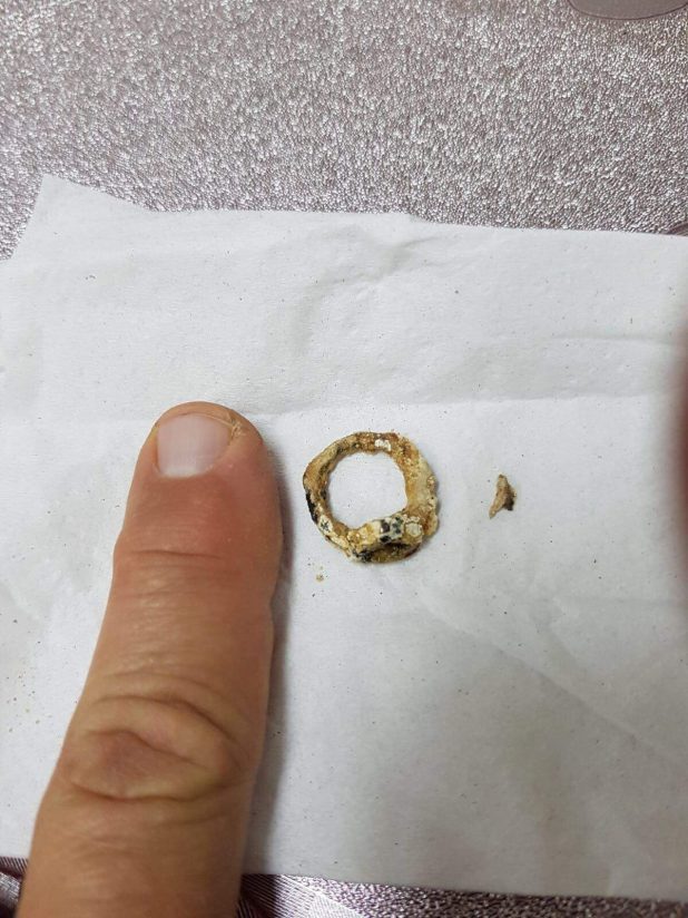 הטבעת שהוצאה מאפבה של הילדה. צילום: דוברות כללית