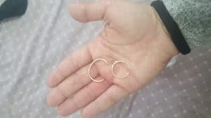 חילוץ טבעת מאצבעותיה של אישה | צילום: דוברות כיבוי והצלה